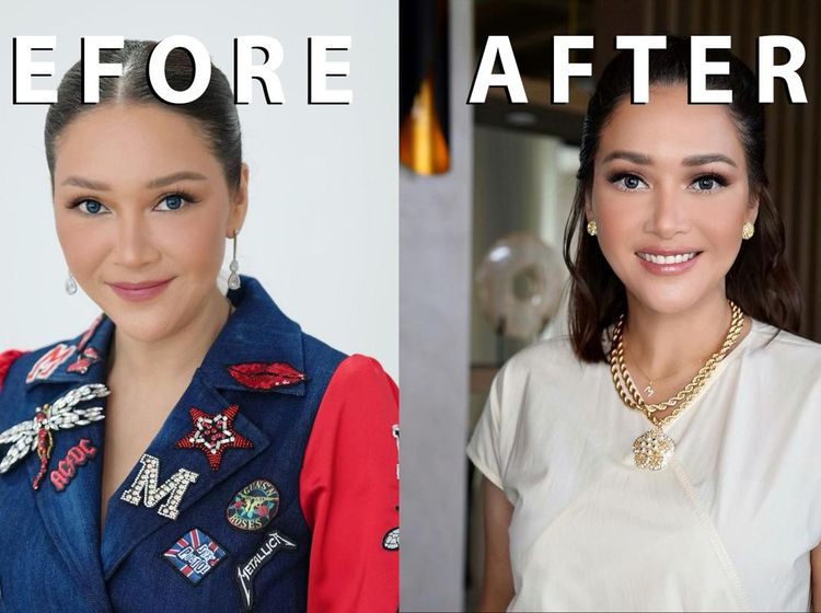 10 Potret Maia Estianty Sebelum vs Sesudah Laser-Botox