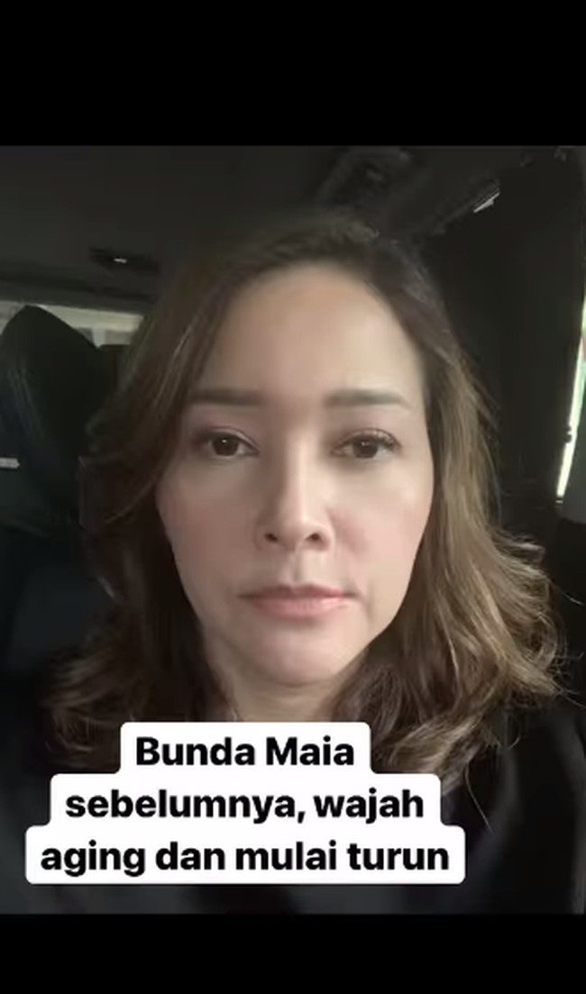 Beginilah wajah wanita yang akrab disapa Bunda tersebut sebelum perawatan di klinik kecantikan EMK Beauty Lounge Indonesia. Tampak sudah terlihat tanda-tanda penuaan, dan wajahnya turun. Foto: dok. Instagram/@emkbeautylounge.id