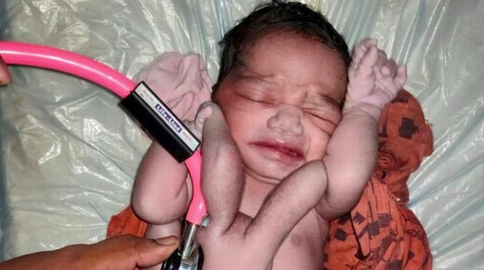 Bayi Dewi
