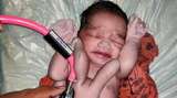 Bayi Dewa Punya Empat Tangan dan Kaki Lahir di India