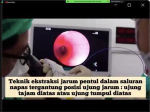 Duh! Gadis asal Depok Ini Tersedak Jarum Pentul Saat Benerin Hijab