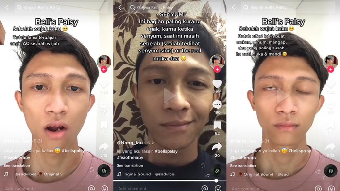 Viral TikTok Viral TikTok seorang pria mengalami bells palsy, mengaku karena sering terpapar angin AC.