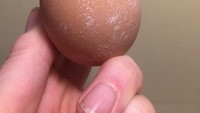 Bukan es krim atau lelehan cokelat, ini adalah telur ayam yang punya bentuk aneh. Wah, kok bisa ya? Foto: Pool/Site/Reddit