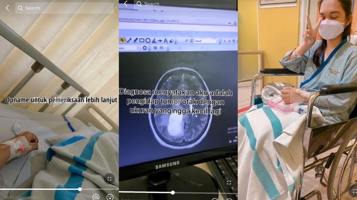 Seorang wanita asal Jakarta Barat mengaku terkena tumor otak.