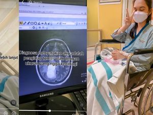 Kronologi Wanita 20 Tahun Kena Tumor Otak, Gejala Awal Sering Migrain
