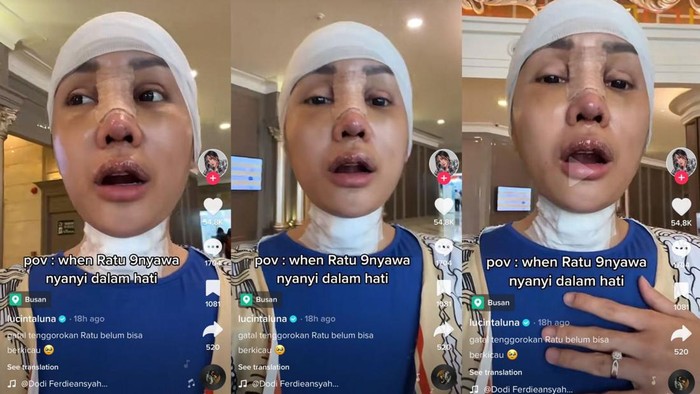 Lucinta Luna operasi Lucinta Luna operasi jakun