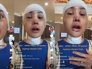 Tembolok Belum Kering, Kapan Suara Lucinta Luna Mulai Berubah?