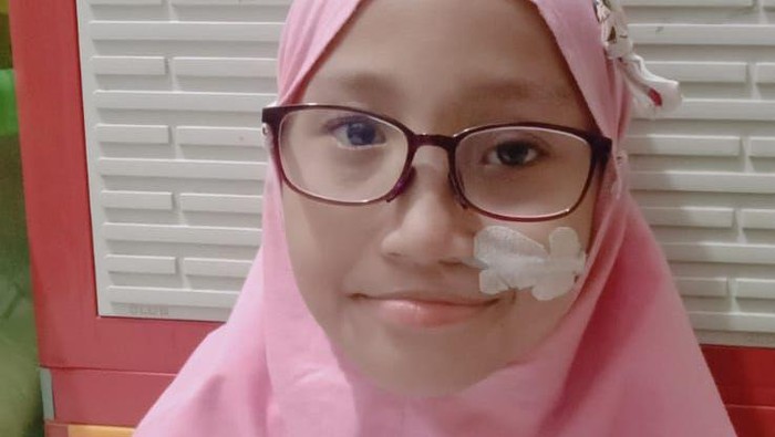Rumman Haura Nabila (9) adalah anak istimewa penderita Sindrom Wolf Hirschhorn. Kini, Haura mendapatkan donasi dari sahabat baik untuk membeli susu khusus.
