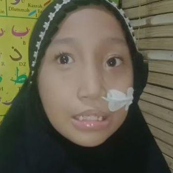Rumman Haura Nabila (9) adalah anak istimewa penderita Sindrom Wolf Hirschhorn. Kini, Haura sudah mendapatkan donasi dari sahabatbaik untuk membeli susu khusus.