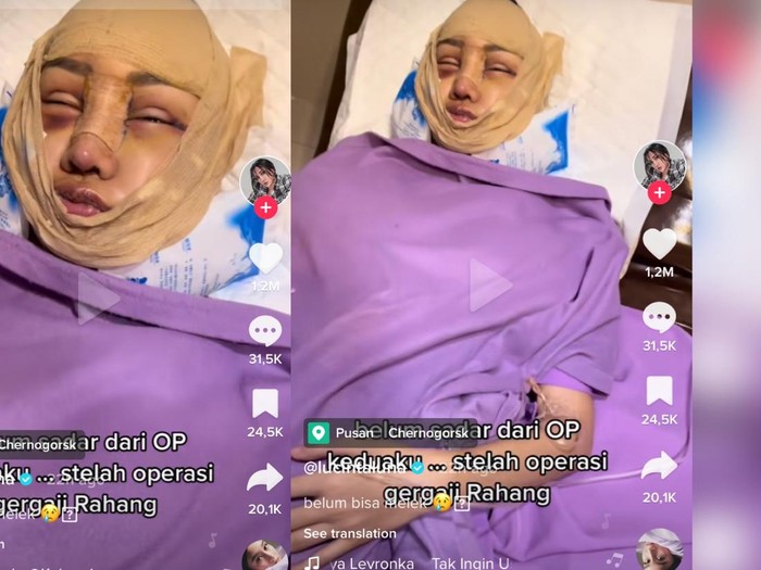 Cerita Lucinta Luna gergaji rahang.
