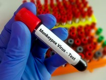Penjelasan Satgas soal Urgensitas Penggunaan Masker di Tengah Wabah Mpox