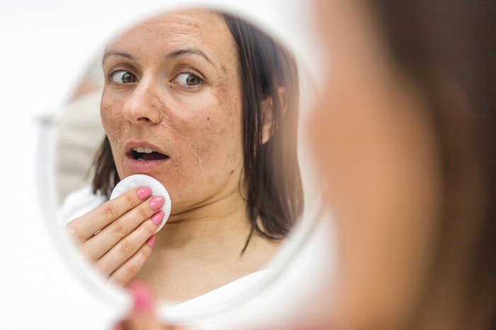 Photo of woman having skin problems looking in the mirror. Concept of skincare.