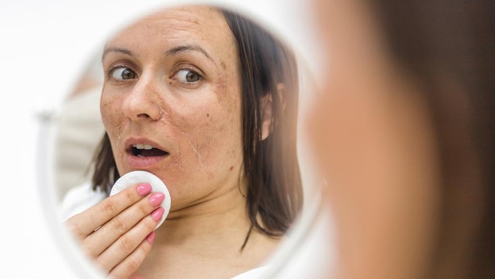 Ilustrasi Flek Hitam Photo of woman having skin problems looking in the mirror. Concept of skincare.