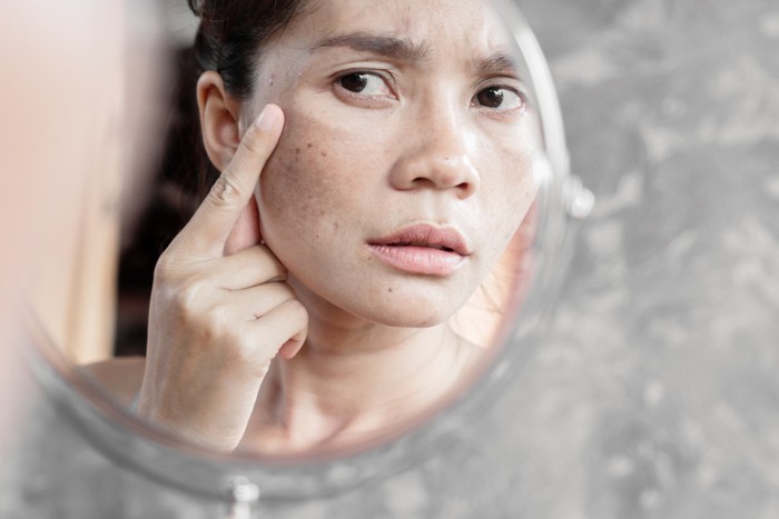 Asian woman having skin problem checking her face with dark spot, freckle from uv light in mirror