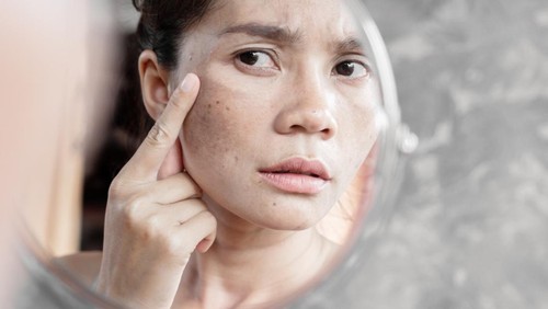 Asian woman having skin problem checking her face with dark spot, freckle from uv light in mirror