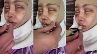 Beberapa hari setelah operasi khodam dan pengangkatan tulang ekor, Lucinta Luna mengaku sudah kembali fit, hingga bisa mengunggah beberapa video joget TikTok. Semangatin Ratu yah guys… lagi belajar berdiri biar tulang ekornya Ratu tetap slay, kata Lucinta. (Foto: Tangkapan layar TikTok @lucintaluna)