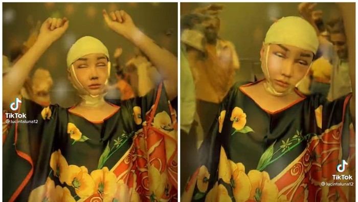 Lucinta Luna Kayang Pasca Operasi, Berakhir Jahitan Sobek