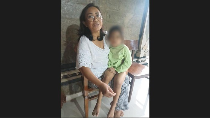 Anak kecil yang mengaku bernama Naya ditemukan telantar dengan luka memar dan kaki patah di Desa Sidakarya, Kecamatan Denpasar Selatan, Kota Denpasar.