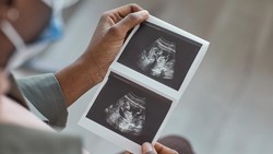 RUU Kesehatan Juga Singgung Aborsi, Poin Ini Jadi Sorotan Dokter Kandungan