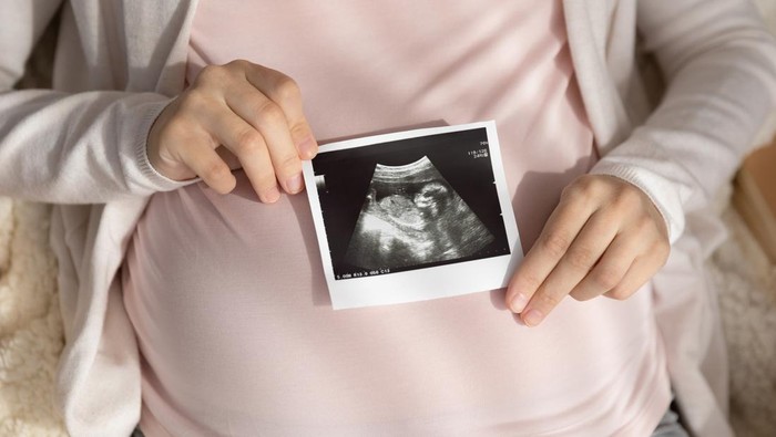 USG Tiap Bulan Bahaya untuk Janin, Mitos atau Fakta? Begini Penjelasan Obgyn