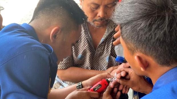 Proses pelepasan cincin terjebak di jari.