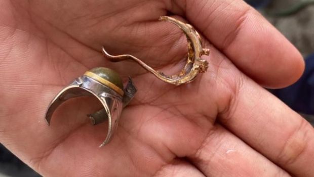 Proses pelepasan cincin terjebak di jari.