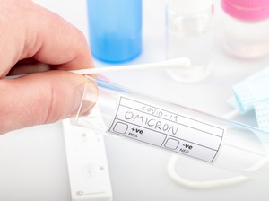 COVID-19 RI Merangkak Lagi, Kemenkes Duga Omicron XBB Jadi Biang Kerok