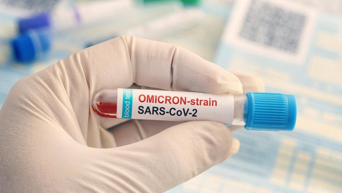 Ilustrasi Omicron Centaurus Doctor with a positive blood sample for new variant detected of the coronavirus strain called covid Omicron. Research of new african strains and mutations of the Covid 19 coronavirus in the laboratory