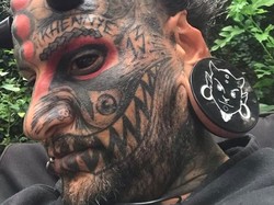 8 Foto Penampakan Pria yang Implan Tanduk di Dahi, Bak Manusia Setan