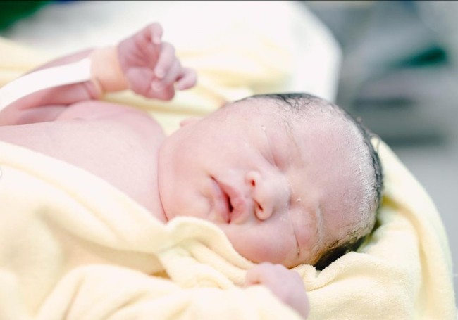 Aliya Rajasa dan Edhie Baskoro Yudhoyono sedang berbahagia. Anak keempat mereka lahir dengan selamat melalui operasi caesar. Foto: Instagram/@ibasyudhoyono