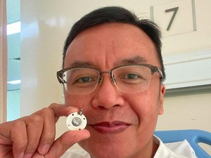 Puji Tuhan... Selesai Rangkaian Pengobatan Kanker Langka Ari Lasso