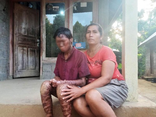 Koman Tisna Yasa bersama dengan sang ibu Nengah Sinar, saat ditemui dirumahnya di Banjar Dinas Rendetin, Desa Bontihing, Kecamatan Kubutambahan, Kabupaten Buleleng, Bali.