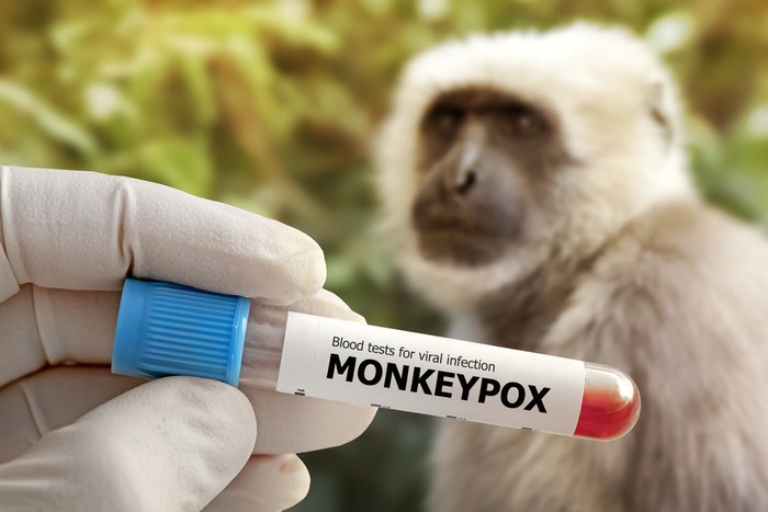 Monkeypox positive