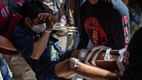 Empat orang pelaku dihadirkan dengan luka di bagian kakinya.