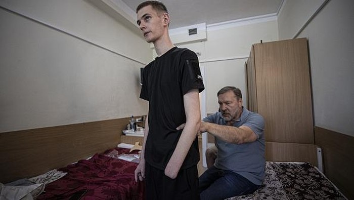 KYIV, UKRAINE - JULY 22: Daniyel Melnik, 19-year-old Ukrainian sergeant who partially lost his legs, left wrist and 4 fingers on his right hand in Russia-Ukraine war, is being received treatment in a rehabilitation center in Kyiv, Ukraine on July 22, 2022. Despite his disability, Melnik wants to become a military psychologist and serve in the army again. (Photo by Metin Aktas/Anadolu Agency via Getty Images)