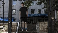 Daniyel kini harus membiasakan dirinya menggunakan kaki palsu untuk berjalan.  