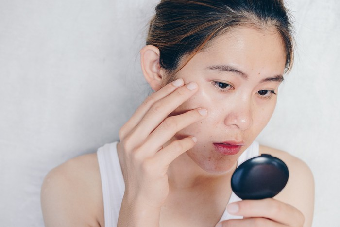Ilustrasi Skincare Kulit Berminyak Conceptual shot of Acne & Problem Skin on female face.