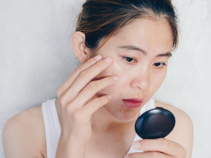 Ilustrasi Skincare Kulit Berminyak Conceptual shot of Acne & Problem Skin on female face.