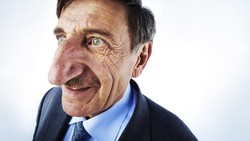 Pria Turki berhasil mencatatkan namanya di Guinness World Records sebagai pria pemilik hidung terpanjang di dunia pada orang yang masih hidup.