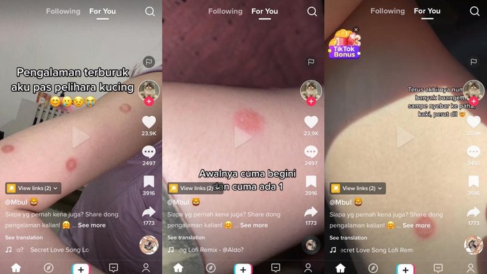 TikTok Ringworm Tangkapan layar viral TikTok