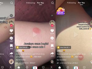 Heboh di Tiktok Wanita Derita Ruam Sekujur Tubuh gegara Kucing