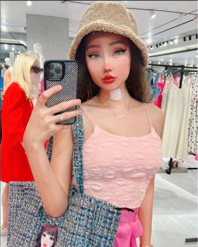 Beragam rangkaian operasi plastik itu diakui Lucinta dijalani di Korea. Walaupun masih mengenakan plester di lehernya, namun Lucinta terlihat sudah bisa kembali beraktivitas normal, seperti di dalam foto ketika dirinya tengah berjalan-jalan di salah satu mall. Foto: Instagram/@lucintaluna_manjalita