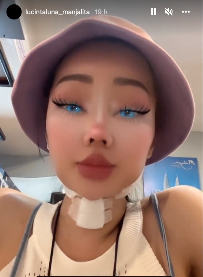 Terbaru melalui Instagram Story Lucinta Luna menceritakan jika jahitan lehernya kembali basah karena ia memakan seafood. Ia mengungkapkan jika jahitan di lehernya itu jadi gatal-gatal, padahal sudah 2 minggu dari semenjak operasi. Foto: Instagram/@lucintaluna_manjalita