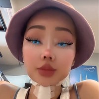 Terbaru melalui Instagram Story Lucinta Luna menceritakan jika jahitan lehernya kembali basah karena ia memakan seafood. Ia mengungkapkan jika jahitan di lehernya itu jadi gatal-gatal, padahal sudah 2 minggu dari semenjak operasi. Foto: Instagram/@lucintaluna_manjalita