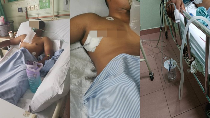 paru-paru bocor gegara vape Duh! Paru-paru Pria Ini Bocor Gegara Kebiasaan Ngerokok Plus Ngevape