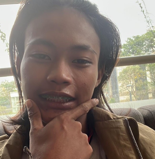 Nama Bonge mulai dikenal karena dirinya seringkali nongkrong di kawasan BNI City, Sudirman. Kawasan tempatnya menongkrong itu yang kini tengah viral dan disebut sebagai Citayam Fashion Week. Karena viral, Bonge pun jadi mendapat banyak tawaran pekerjaan dan menjadi bintang tamu di acara-acara. Foto: Instagram/@bonge.sudirman