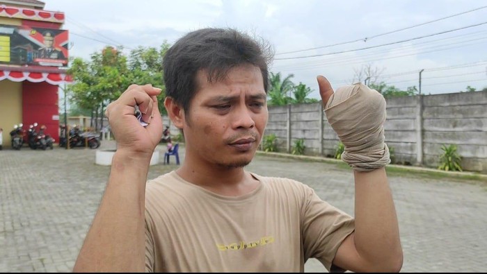 Fandi Ahmad saat menunjukkan jarinya yang putus dibacok saat berada di Polsek Patumbak. (Foto: Istimewa)