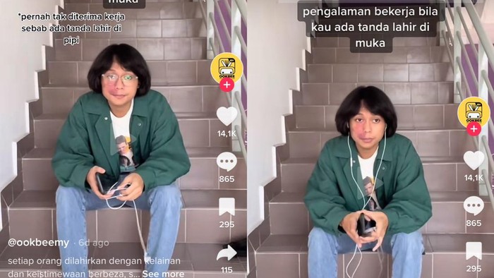 Viral TikTok Viral seorang pria menceritakan pengalaman ditolak kerja karena punya tanda lahir.