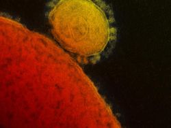 10 Foto Virus Jahat yang Dipotret Mikroskop, Bikin Terperangah