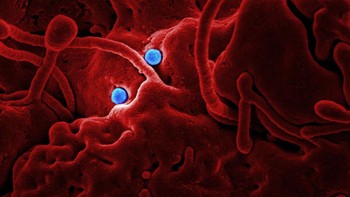 Masih dengan virus Corona, kali ini berbentuk bola berwarna biru.